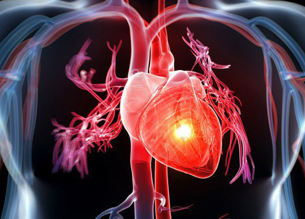 Các bệnh lý về tim mạch là nguyên nhân hàng đầu gây tử vong trên toàn thế giới