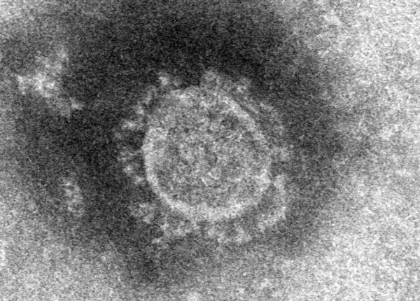 Hình ảnh thực tế virus corona