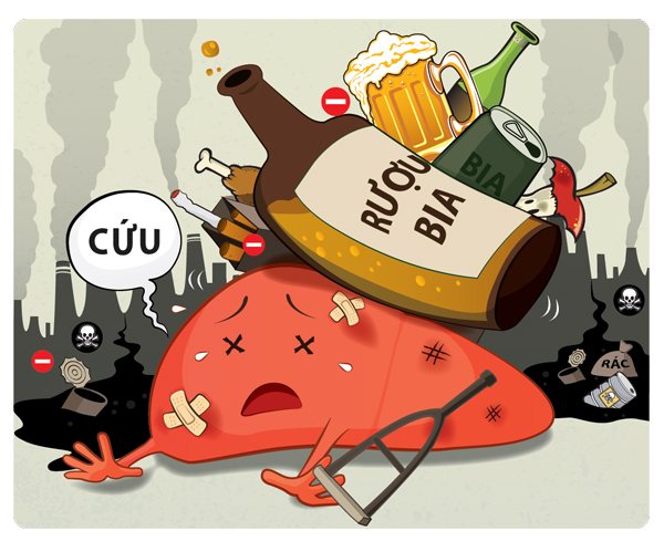 Rượu bia được xác định là nguyên nhân chính gây nên ung thư gan